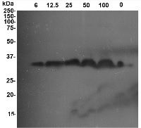 PR-2 | GLU I | Class I beta-1,3-glucanase in the group Antibodies Plant/Algal / Environmental Stress / Pathogen attack at Agrisera AB (Antibodies for research) (AS07 208)
